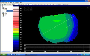 Instrument de topographie cornéenne multifonctionnel SW6000 <span class=keywords><strong>Topographe</strong></span> cornéen Équipement ophtalmique topographique - Product Image 5