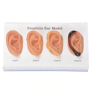 Maniquí DARHMMY para Demostrar las Etapas Progresivas de Congelación de las Orejas, de Leve a Severa, para Enseñanza Médica - Product Image 1