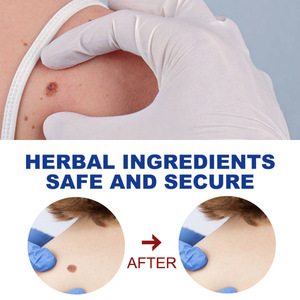 Lápiz Líquido <span class=keywords><strong>para</strong></span> Eliminar <span class=keywords><strong>Verrugas</strong></span> y Papilomas, Tratamiento <span class=keywords><strong>para</strong></span> Eliminar <span class=keywords><strong>Verrugas</strong></span> - Product Image 6