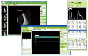 Escaneo oftálmico profesional de China, escáner oftálmico a, pacheymeter oftálmico, a prueba de agua, al por mayor, al por mayor - Product Image 5