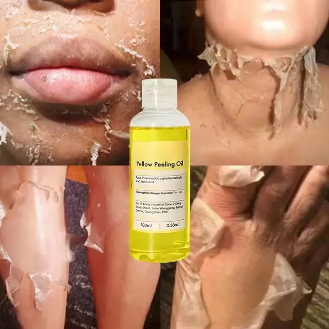 Extra Strength Yellow Peeling Oil Face And Body Knuckles Skin Whitening Remove Dead Skin Exfoliating Anti Dark Spots Oil