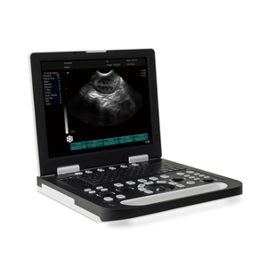 Appareil à ultrasons Portable B/W bon marché pour le balayage de la <span class=keywords><strong>grossesse</strong></span> des animaux de l'<span class=keywords><strong>h</strong></span>ôpital vétérinaire - Product Image 4