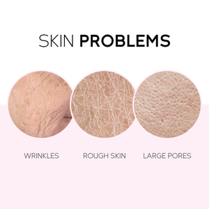 Etiqueta privada personalizada Anti-Acné Eliminador de manchas oscuras Juego de suero de tóner facial 5 piezas Cuidado DE LA PIEL Ingredientes de vitamina C Sakura Blanqueamiento DE LA PIEL - Product Image 5