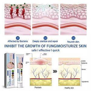 Мазь от псориаза «Южная Луна», 20 г - Product Image 2