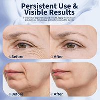 Eveekon 2026 Masajeador Eléctrico Portátil para Rostro y Cuello con Vibración para el Cuidado de la Piel, Dispositivo de Masaje Facial Antiarrugas