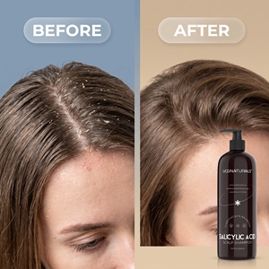 Shampoo équilibrant pour le cuir chevelu pour femmes et hommes, réduit l'accumulation, acide salicylique, antipelliculaire, clarifiant, rafraîchissant, pH 4,5-6,5, sec - Product Image 5