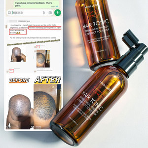 Spray OEM per la Crescita dei Capelli con Caffeina, Blocca DHT, Anti-Caduta, <span class=keywords><strong>Tonico</strong></span> Nutriente per <span class=keywords><strong>il</strong></span> Cuoio Capelluto con Estratto di Rosmarino e Saw Palmetto - Product Image 1