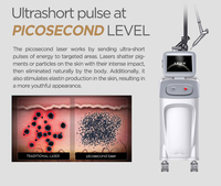 Laser picoseconde Q-switch ADSS 1064 nm 532 nm pour l'élimination des pigments et des tatouages, machine laser pico