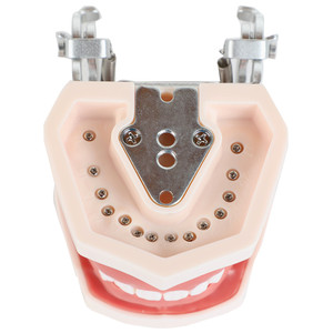 Mejor Modelo Dental de Enseñanza con 28 Dientes de Resina, Encías Blandas Desmontables para Práctica de Implantes, Equipo de Terapia Oral - Product Image 4