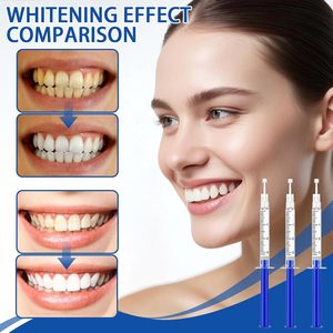6 recharges de gel blanchissant pour les dents, seringues de gel blanchissant pour les dents de 3 ml pour les dents sensibles, pour un sourire plus éclatant et sans taches - Product Image 4