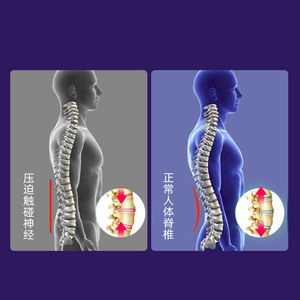 Masseur électrique domestique MRT-96 36V en forme de papillon pour la correction lombaire et le soulagement des douleurs dorsales - Product Image 1