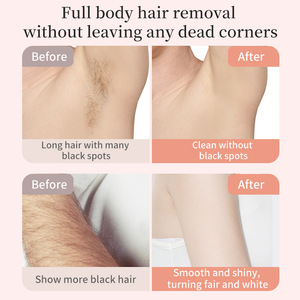 Rasoir électrique 2-en-1 à double tête détachable pour femmes Rasoir à cheveux imperméable et humide pour bikini épilateur tondeuse - Product Image 2