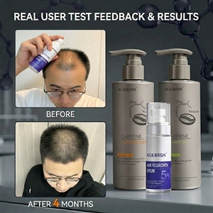 <span class=keywords><strong>Shampoo</strong></span> Bloccante DHT alla Caffeina, Ferma l'Assottigliamento dei <span class=keywords><strong>Capelli</strong></span> e Promuove la <span class=keywords><strong>Crescita</strong></span> Sana, Senza Solfati e Parabeni - Product Image 6