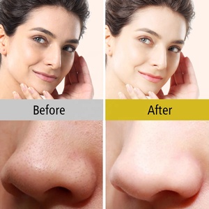 Gold star — <span class=keywords><strong>masque</strong></span> facial à paillettes, étiquette privée, de beauté, éliminateur de points noirs, à la mode - Product Image 6