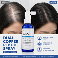 Sérum capillaire en spray aux peptides de cuivre GHK-CU AHK-CU, activation des follicules, soin du cuir chevelu, traitement des cheveux clairsemés, traitements de repousse des cheveux