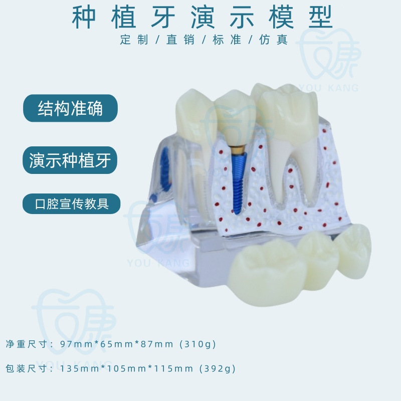 C dental implant transparent blue nail