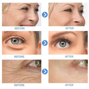 2023s חם מכירה יפנית מסיסים מים משי כדור כדור הקולגן חוט קולגן טבעי משי פיברום - Product Image 5