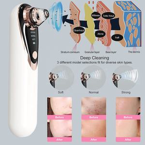 Cepillo de limpieza <span class=keywords><strong>Facial</strong></span> para espinillas y acné, eliminador de espinillas y puntos negros, aparato de belleza - Product Image 6