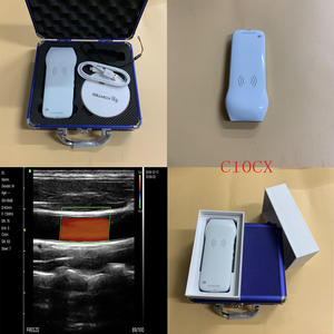 KONTED Máquina de ultrasonido portátil Wifi Color Doppler Escáner de ultrasonido inalámbrico Sonda de ultrasonido lineal de mano - Product Image 3