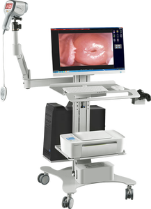 Para el colposcopio ginecológico de vídeo HD Kernel para la detección del cáncer cervical Carro de metal eléctrico incluido - Product Image 5