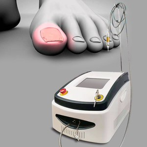 Láser de diodo de alta potencia 980nm Dispositivo de terapia de <span class=keywords><strong>hongos</strong></span> <span class=keywords><strong>en</strong></span> las uñas Eliminación de onicomicosis y verrugas <span class=keywords><strong>en</strong></span> <span class=keywords><strong>los</strong></span> <span class=keywords><strong>pies</strong></span> - Product Image 4