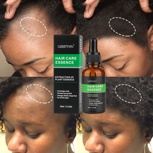 Private Label Ginger Natural Organic Hyaluronic Acid Nourishing Fluffy Anti Loss Regrowth Biotin Fast Hair Growth Oil Serum - Product Image 5