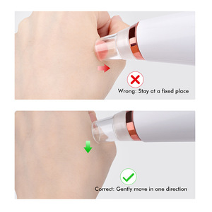 Aparato eléctrico para el cuidado de la piel, limpieza de nariz Facial, eliminación de exfoliación de cabeza negra, limpiador de poros, succión de comedón al vacío, removedor de espinillas - Product Image 5