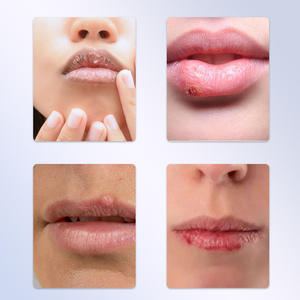 Échantillon gratuit de crème hydratante et hydratante pour les lèvres de haute qualité pour les lèvres sèches et craquelées - Product Image 3