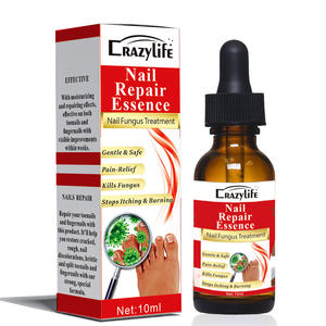 10ml efficace riparazione delle unghie siero essenze Anti fungo rimuovere onicomicosi punta nutriente Logo personalizzato pronto per la spedizione - Product Image 3