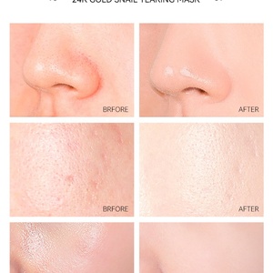 Mascarilla Facial Desprendible LANCER KING 24K Gold Snail Tearing de 50g, Limpieza Profunda, Control de Grasa, Reducción de Poros, Cuidado de la Piel - Product Image 5