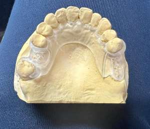 Disco Flessibile in <span class=keywords><strong>PMMA</strong></span> Acrilico Dentale Vsmile HappyZir Certificato CE, Spessore 12mm per Laboratorio Dentale CADCAM - Product Image 5