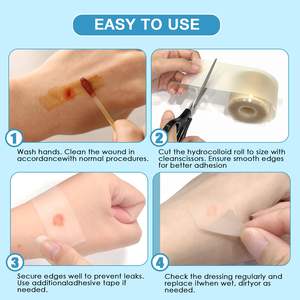 YOJO - Rollo de Parches Hidrocoloides Autoadhesivos, Personalizables en Tamaño y Forma, Esterilizados con Óxido de Etileno, Certificados por la CE, para el Cuidado de Heridas, Quemaduras y Ampollas - Product Image 6