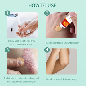 Vente en gros OEM de crème à base de plantes qui soulage rapidement les démangeaisons causées par l'eczéma et le psoriasis - Product Image 6