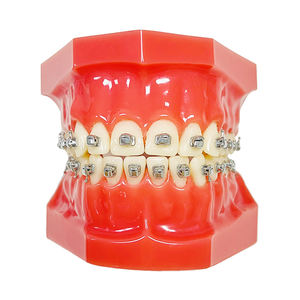 Supports orthodontiques chauds Brillant 1G Attelle auto-ligaturante Supports de style Damon - Product Image 6