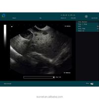 EUR VET Prix d'usine Appareil à ultrasons Doppler couleur 3D 4D portable Équipement de diagnostic vétérinaire de haute qualité pour vache