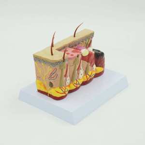 Modèle stéréoscopique 3D de la peau brûlée, modèle médical de la structure de la peau humaine, modèle d'enseignement des blessures, comparaison des brûlures pour l'éducation médicale CE/ISO - Product Image 3