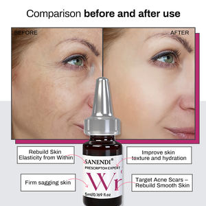 Suero OEM Exo Capsule Skinbooster con Péptidos, Antialérgico, Blanqueador, Hidratante, Elimina Pecas, Antiarrugas, Solución para el Tratamiento del Acné - Product Image 5