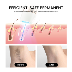 Épilateur laser IPL portable Moolweel T003, efficace pour une utilisation à domicile, réutilisable, épilateur IPL permanent avec <span class=keywords><strong>lumière</strong></span> <span class=keywords><strong>pulsée</strong></span> pour femmes et hommes - Product Image 2