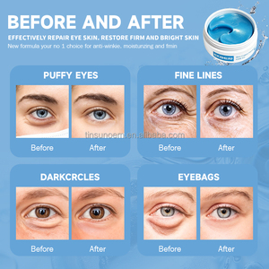 Masque pour les yeux naturel personnalisé EKBER avec logo, peau lisse, réduit les ridules, éclaircit la peau, patchs pour le contour des yeux, marque privée - Product Image 3