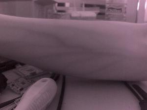 2MP Y Tế Máy Ảnh Tĩnh Mạch Chụp Iris Chụp USB Y Tế Hồng Ngoại Máy Ảnh - Product Image 5