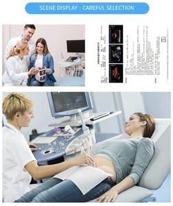 إنتاج فيلم الأشعة السينية الطبي الجاف الأبيض والأزرق القائم على الليزر A4 250mic - Product Image 6