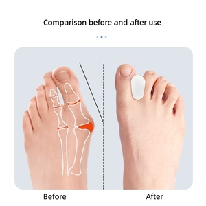 Hot Sale Waterproof Gel Toe Separators &amp; <strong>Bunion</strong> <strong>Protector</strong> Temporary <strong>Bunion</strong> Corrector Orthotic for <strong>Bunions</strong> &amp; Overlapping Toe Pain - Product Image 5