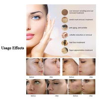 Stylo de Microneedling Professionnel Sans Fil Dr.pen A1W 2020 Bleu, Machine de Microneedling MTS, Outil de Maquillage Permanent