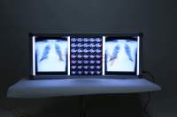 GINEE MEDICAL machine de scan radiologique visionneuse de film à rayons X Hôpital médical visionneuse de film à rayons X à LED hôpital à panneau unique