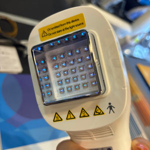 Kernel Handheld 308 Nm Lampe Medizinische UV-Lichttherapie geräte 308nm Effektive Behandlung für Haut krankheiten - Product Image 5