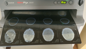 8 "* 10" 14 "* 17" mavi termal medikal <span class=keywords><strong>Film</strong></span> kuru Pix 3500 <span class=keywords><strong>X</strong></span> ışını CT DR MRI CR görüntüleme tıbbi baskı filmi - Product Image 3