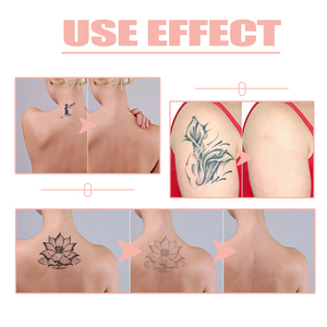 Jaysuing 13g Essence Nettoyante Tatouage, Baume Herbal Raffermissant Antibactérien, Solution d'Élimination des Tatouages, Crème Dissolvante <span class=keywords><strong>pour</strong></span> Broderies et Impressions - Product Image 5