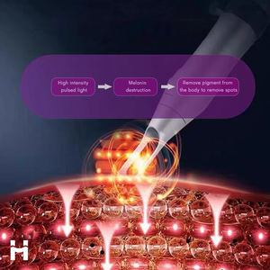 เครื่อ<span class=keywords><strong>ง</strong></span>เลเซอร์กำจัดเม็ดสีรอยสักแบบพิโคเซคันด์ อุปกรณ์ความงามเลเซอร์ Q-Switched Nd:YAG ช่วยปรับปรุงผิวหมอ<span class=keywords><strong>ง</strong></span>คล้ำหรือสีผิวไม่สม่ำเสมอ - Product Image 3