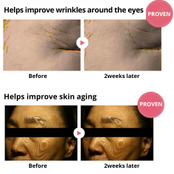 Ensemble de soins de la peau du visage végétalien au kombucha anti-âge hydratant Herbloom pour usage domestique - Product Image 5