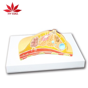 Del seno patologico modello di anatomia Modello di Pratica di Cura del seno modello anatomico - Product Image 6